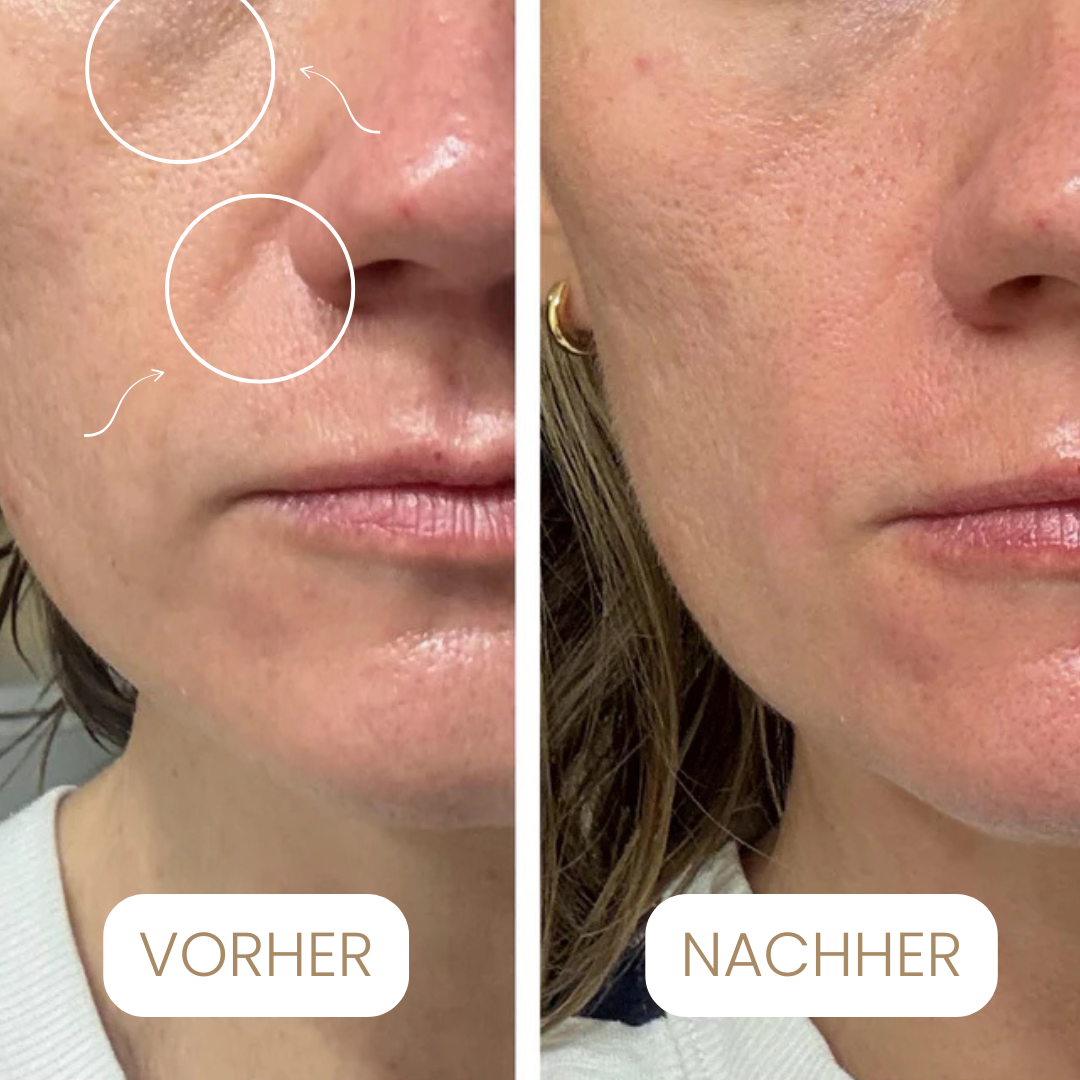 Seoul1988 - 4% Retinal Liposomen Gesichtscrème