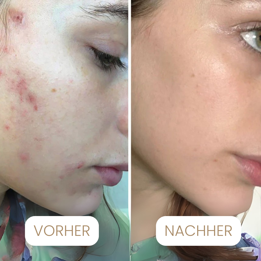 Seoul1988 - 4% Retinal Liposomen Gesichtscrème