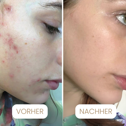 Seoul1988 - 4% Retinal Liposomen Gesichtscrème