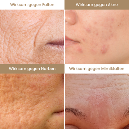 Seoul1988 - 4% Retinal Liposomen Gesichtscrème