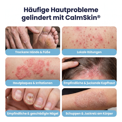 CalmSkin™ - Balance Cream